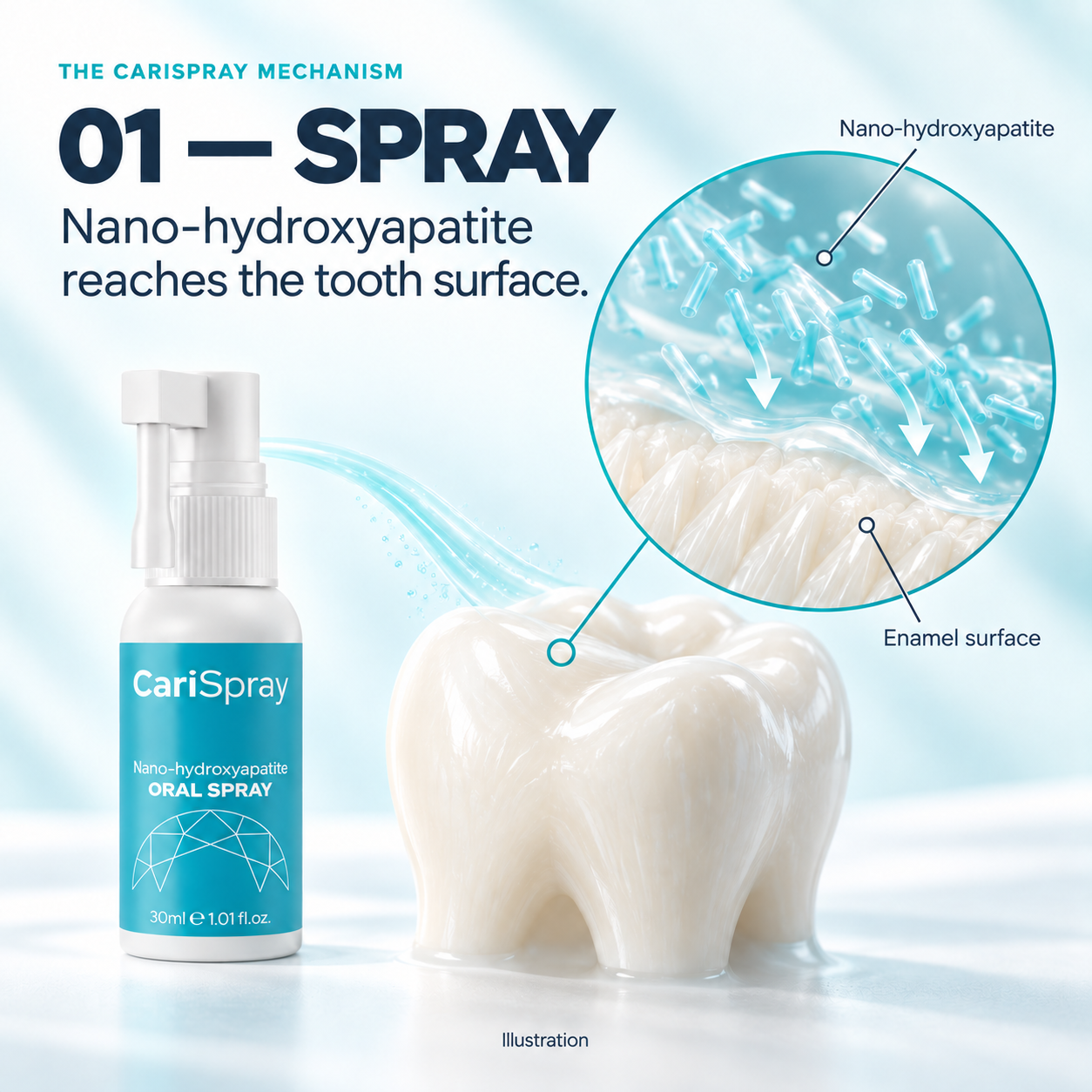 Step 1 — Spray. Nano-hydroxyapatite reaches the tooth surface. Illustration.