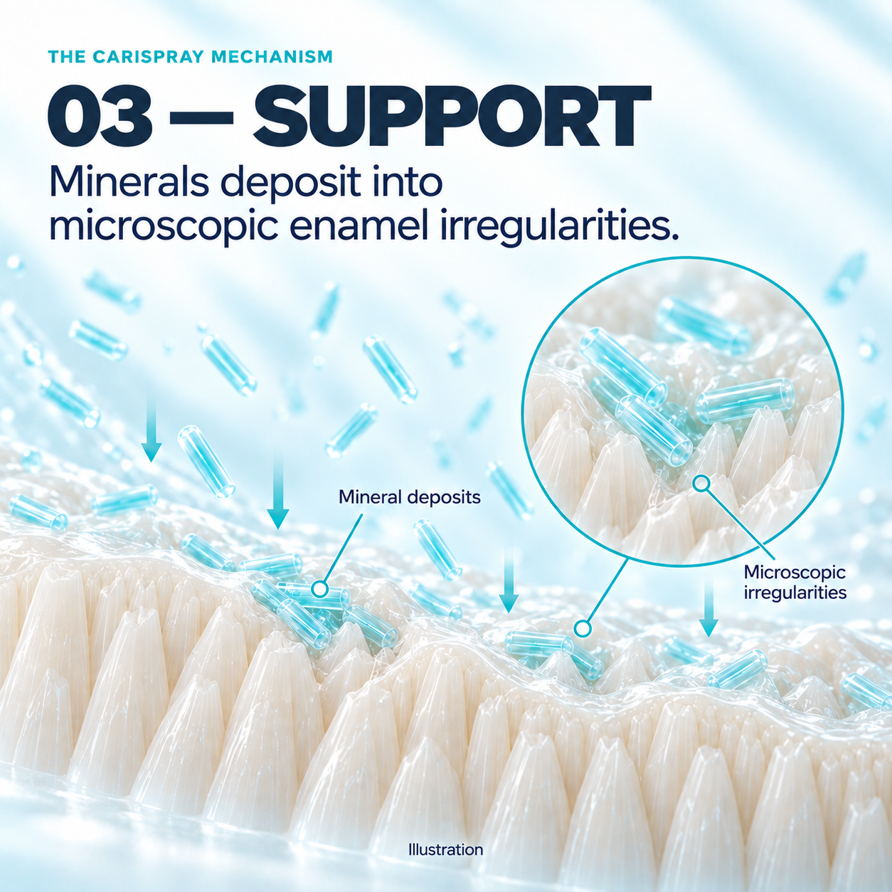 Step 3 — Support. Minerals deposit into microscopic enamel irregularities. Illustration.